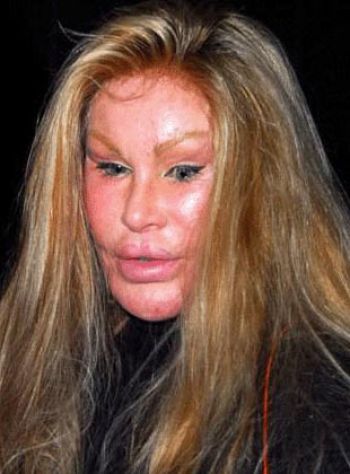 Jocelyne Wildenstein a tellement fait de chirurgie qu’elle en est devenue presque inhumaine 